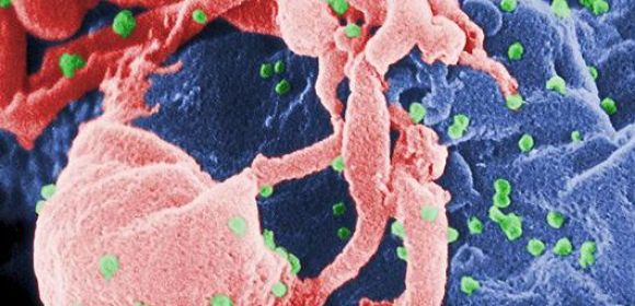 Stem Cells Can Kill HIV-Infected Cells