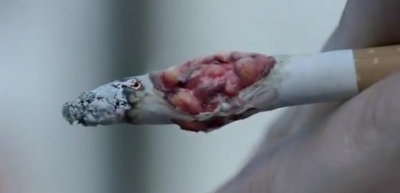 Watch: Most Disgusting Anti-Smoking Advert, Courtesy of UK's Department of Health