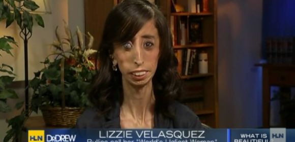 “World’s Ugliest Woman” Lizzie Velasquez Speaks Out: Stop Staring and Start Learning