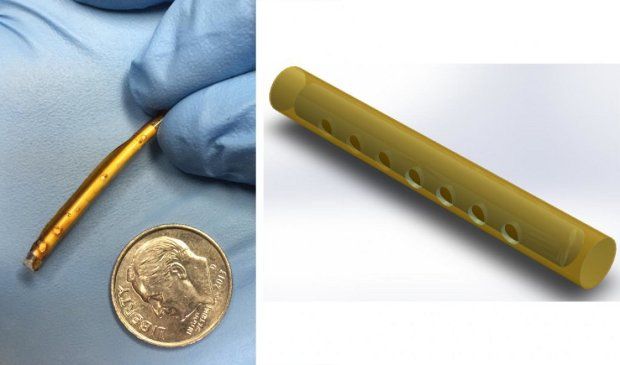 Implantable device promises to make it easier to control HIV/AIDS