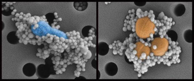 Photo shows MBL-coated nanobeads binding to Escherichia coli (left) and Staphylococcus aureus (right)