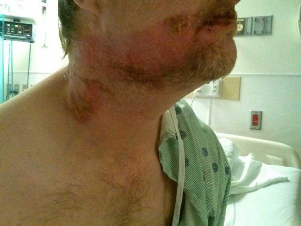Man nearly dies after inhaling air duster