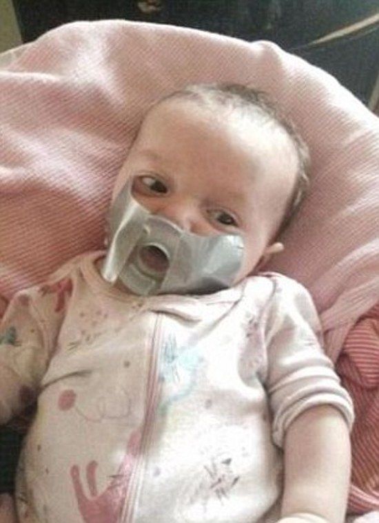 Another photo shows the infant with duct tape on her face