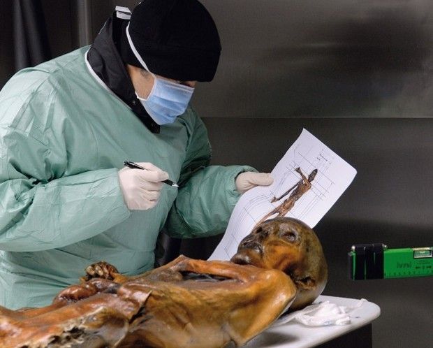 Ötzi the Iceman lived about 5,300 years ago