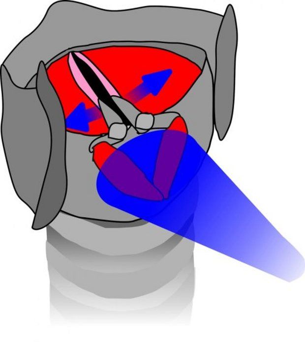 Rear laryngeal muscles genetically altered so that they open the air passage when exposed to light
