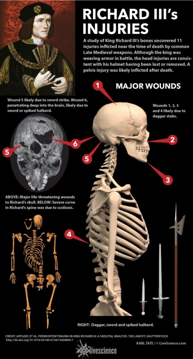 Researchers say that Richard III sustained a total of 11 injuries on the battlefield