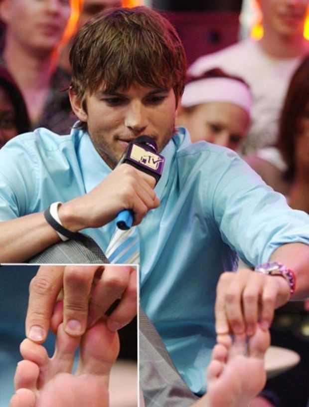 Ashton Kutcher never really hid his webbed toes