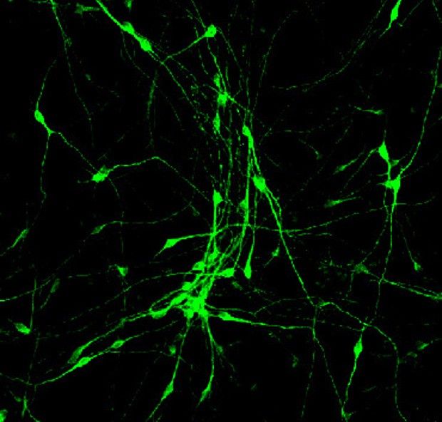 Astroglial cells showing transformation into neurons with long axons and dendrites