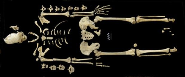 7,000-year-old skeleton shows signs of leukemia