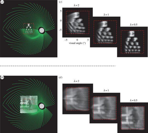 The black and white images show visual distortions that might result from electric prostheses