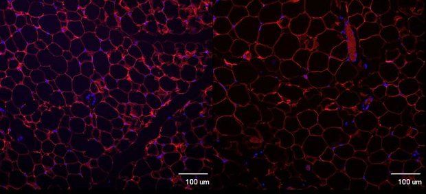 With the obesity gene silenced, fat cells dropped to half their size (left vs. right)