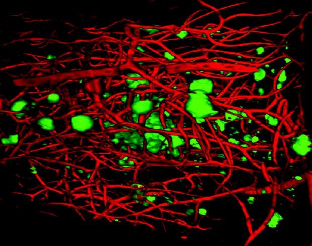 3D visualization of plaques (green) and blood vessels (red) in a mouse brain