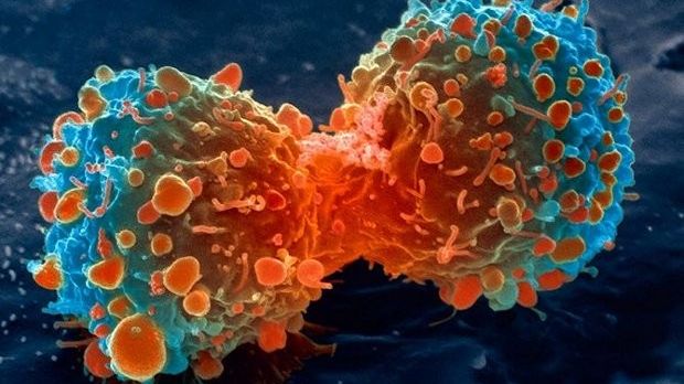 Drug combo destroys cancer tumor