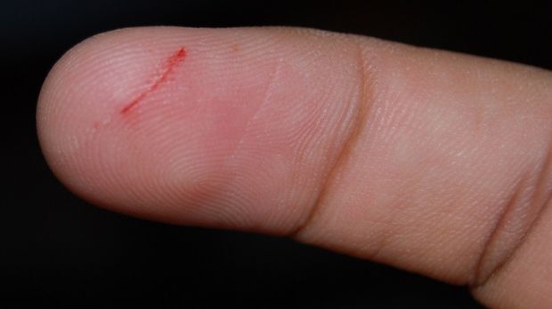 Paper cuts are insanely painful