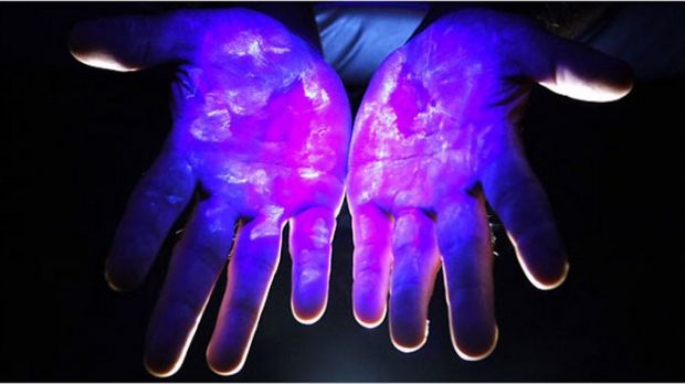 We all have all sorts of germs living on our hands