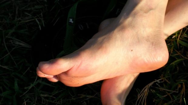 Surgeons pull parasitic worm from man's foot