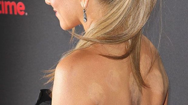 Jennifer Aniston’s cupping marks at the premiere of “Call Me Crazy”