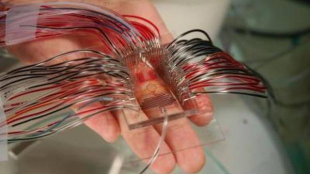 This is a microfluidic device held in the palm of the hand