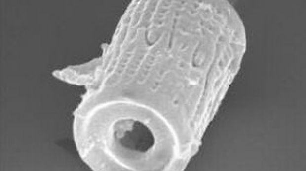 Silicon shell from Aulacoseira diatom