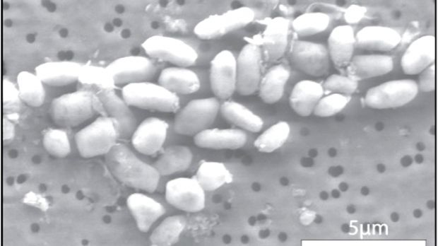 Image of GFAJ-1 grown on arsenic