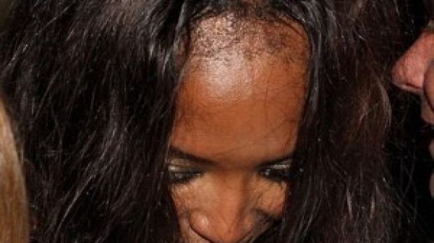 Naomi Campbell's forehead looks worse for wear after a night of hard partying