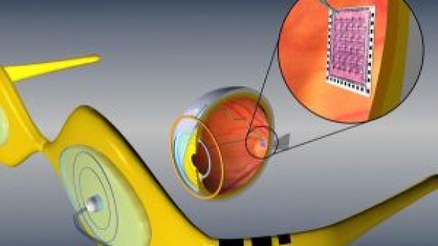 Argus II retinal implant