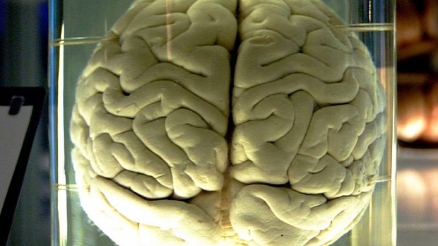 A brain in a jar, not conductive to the research for once