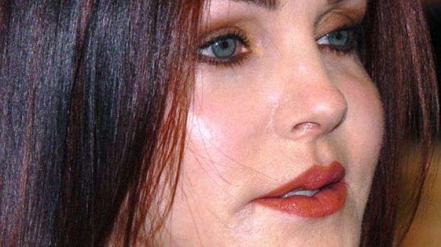 Priscilla Presley, once known for her beauty, has overdone it with fillers, Botox and plastic surgery