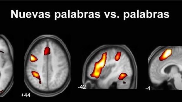Direct fMRI comparison between Spanish words and new words. The bigger activation corresponds to the new words