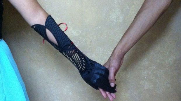Ivania Castillo's new 3D printed prosthetic