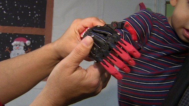 The 3D printed hand