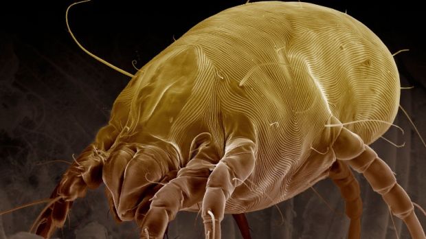 Dust mites are invisible to the naked eye