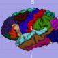 3D Brain Model for the Neurology of the Future