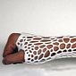 3D Printed Exoskeleton Could Render Traditional Casts Obsolete