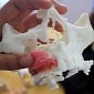 3D Printed Face Model Helps Build Upper Jaw Prosthetic for Cancer Patient – Gallery