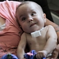 3D Printed Splint Saves Baby's Life by Opening Up His Airway – Video