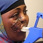 3D Printing Restores the Face of Somalian Woman Shot When She Was Only 2