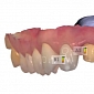 3D Systems Partners with 3Shape for Dental and Buys Medical Modeling Inc.