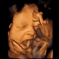 4D Scan Reveals Footage of Fetus Yawning