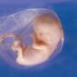 50 Babies A Year Survive Botched Abortions