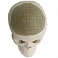 75% of a Man's Skull Replaced by 3D-Printed Implant