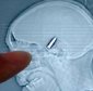 A Chinese Woman Lived for 64 Years with a Bullet in Her Brain!