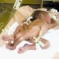A Four-Legged Baby Born in South Africa