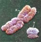 A History of the Sex Chromosomes
