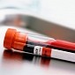 A Simple Blood Test Could One Day Serve to Diagnose Cancer