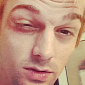 Aaron Carter Gets into Violent Brawl in Boston with NKOTB Fans – Photo