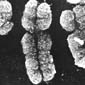About The Stability Of Human Y Chromosome