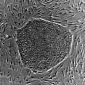 Adult Muscle Cells Can Be Turned into Stem Cells