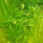 Algae - the Fuel of the Future