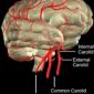 An Ischemic Stroke Kills 8.3 Trillion Synapses in 10 Hours